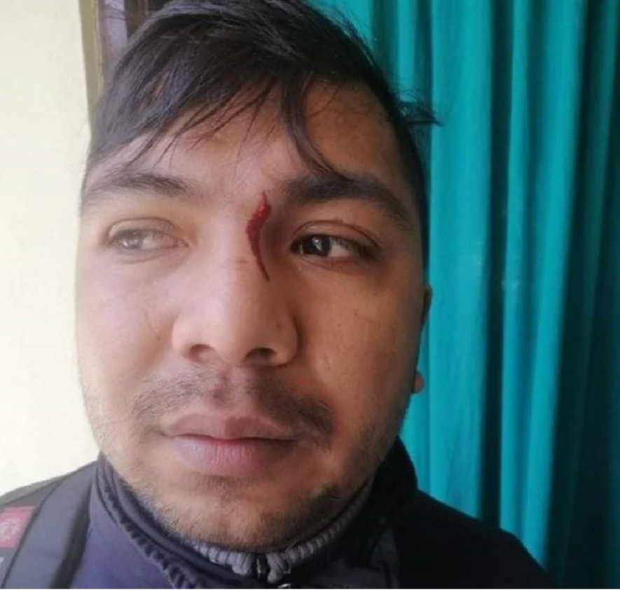 कास्कीका एक जना वडाध्यक्षले कर्मचारीमाथि हातपात