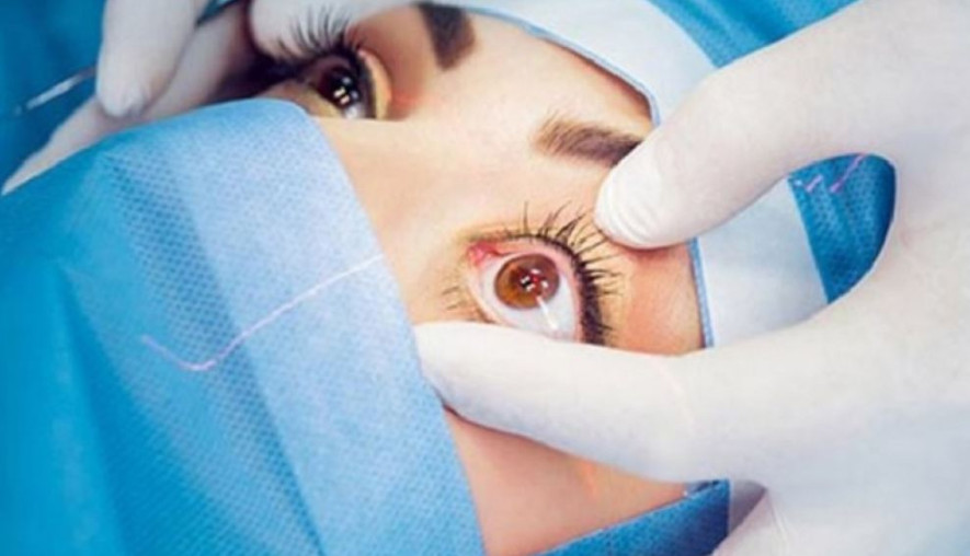 ३९७ जनाको आँखाको निःशुल्क शल्यक्रिया