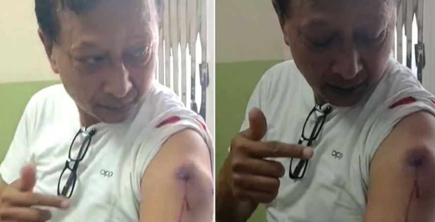 कान्तिपुर टिभीका पत्रकार श्रेष्ठलाई रबरको गोली लाग्यो